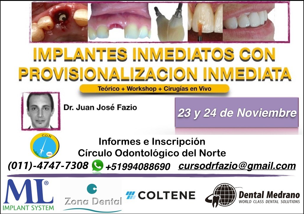 Implantes inmediatos